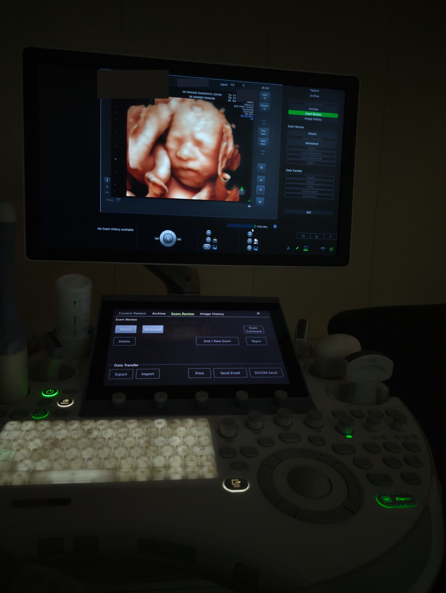 The ultrasound console at the centre, with a 3D image on the monitor
