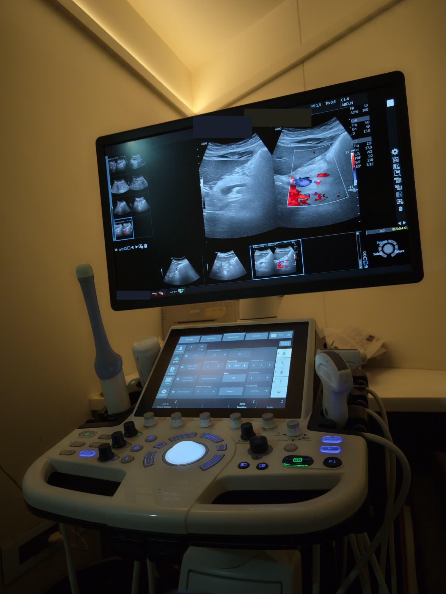 A Colour Doppler study displayed on the ultrasound system at the centre