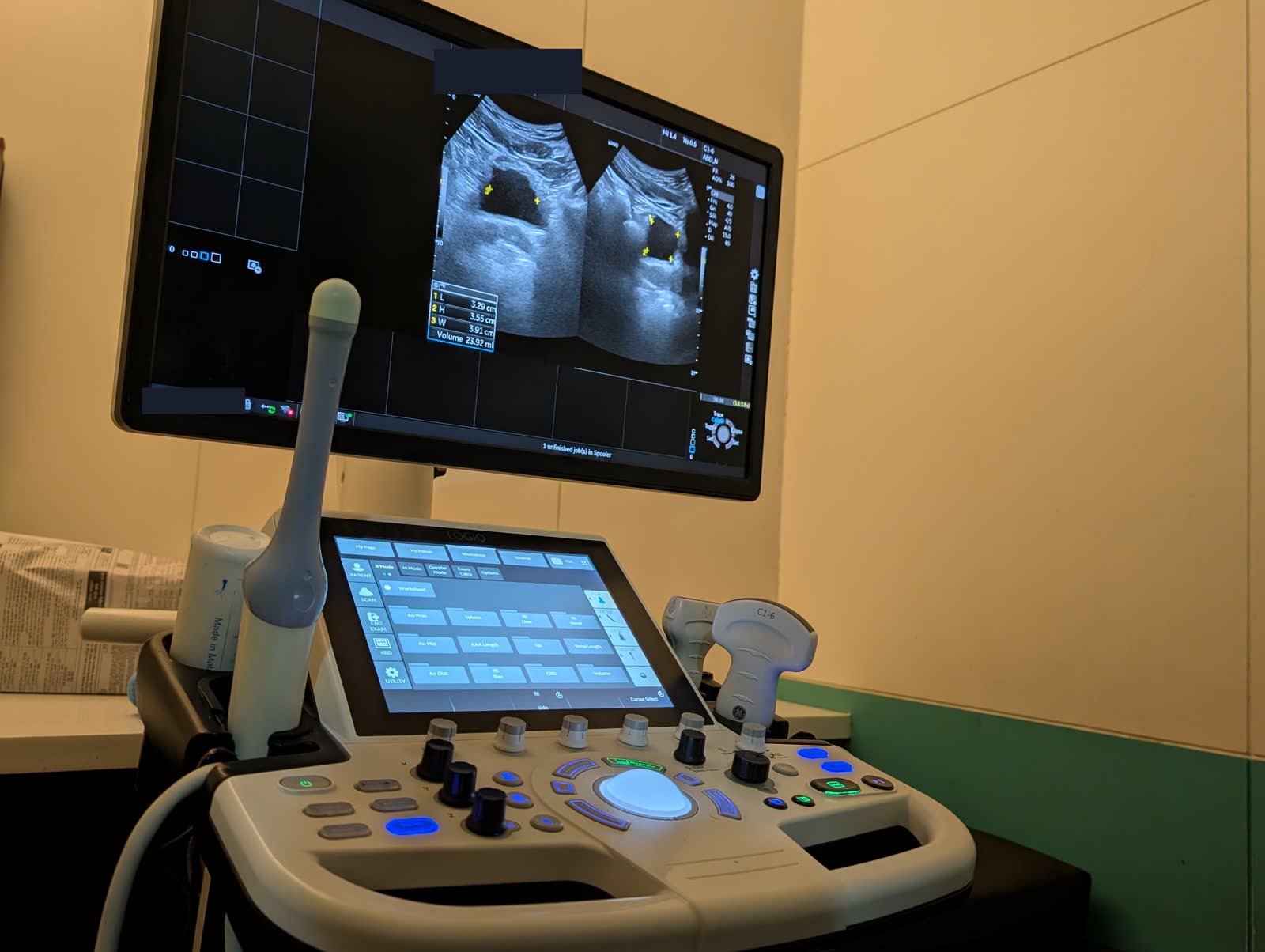 A two-dimensional ultrasound study on the LOGIQ system at the centre