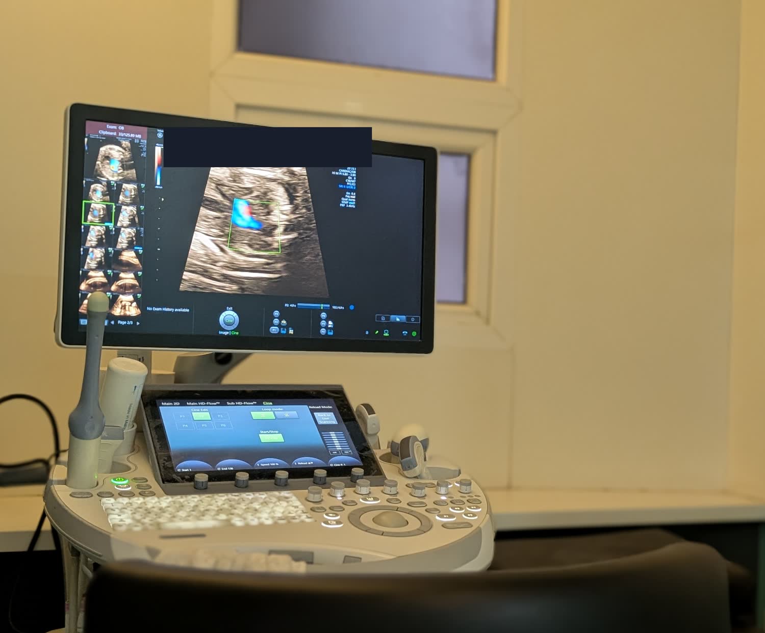 A colour Doppler study on an ultrasound system at the centre